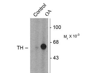Western Blot - Tyrosine Hydroxylase phospho S31 Antibody