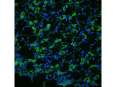 Aquaporin 1 Immunofluorescence