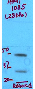 Aquaporin 1 Western Blot