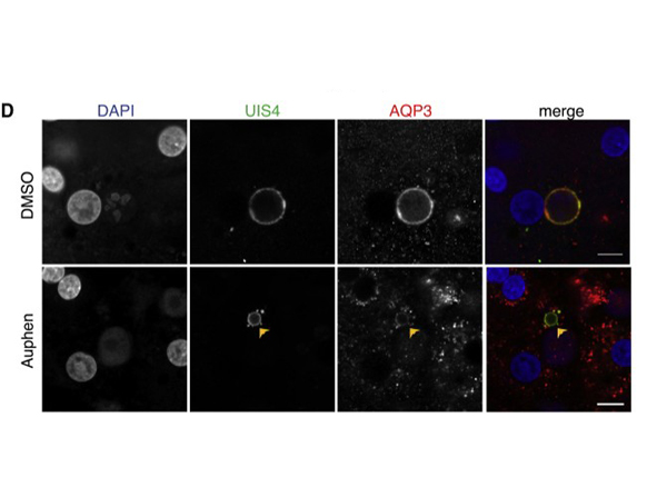 Immunofluorescence using Aquaporin 3