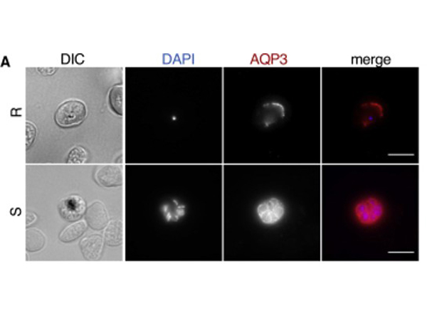 Immunofluorescence using Aquaporin 3