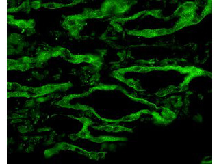 Aquaporin 4 Immunofluorescence