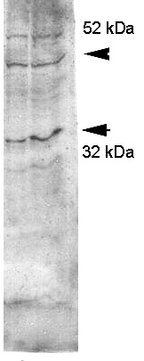 Aquaporin 4 Western Blot