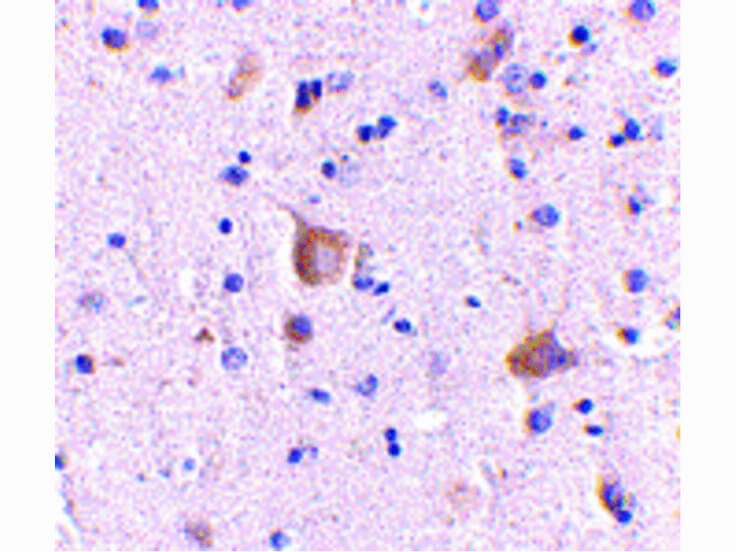 Immunohistochemistry of Rim2 Antibody