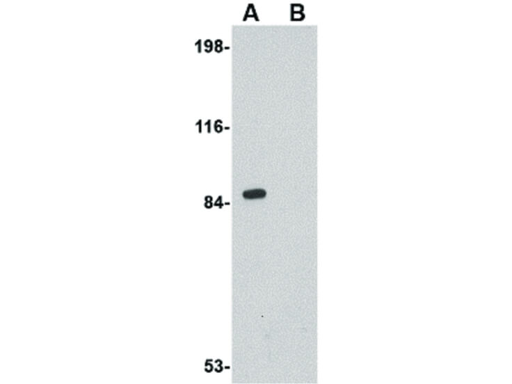 Western Blot of Rim2 Antibody