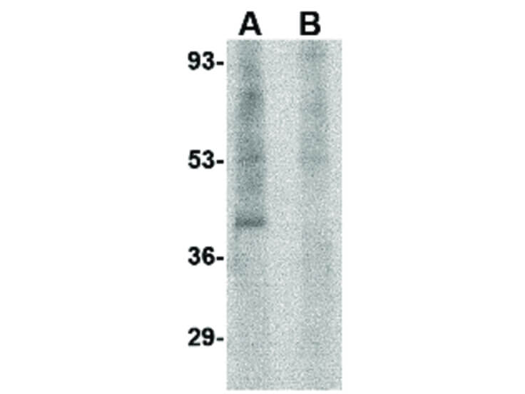 Western Blot of Rim3 Antibody