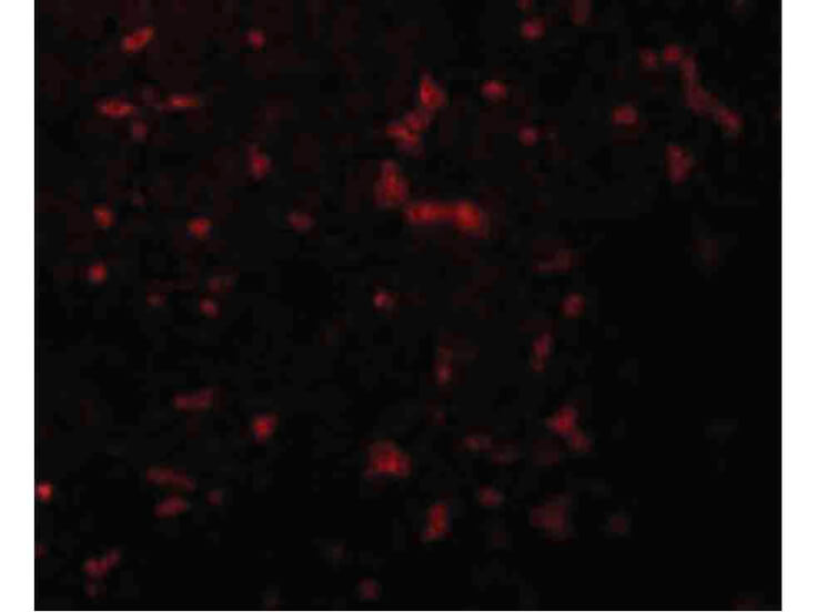 Immunofluorescence of RIPK1 Antibody
