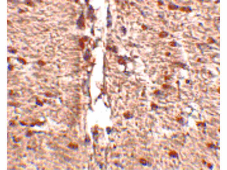 Immunohistochemistry of Rkhd1 Antibody