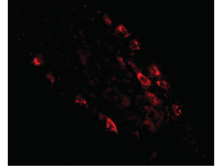 Immunofluorescence of Rkhd1 Antibody