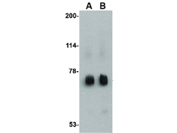 Western Blot of Rkhd2 Antibody