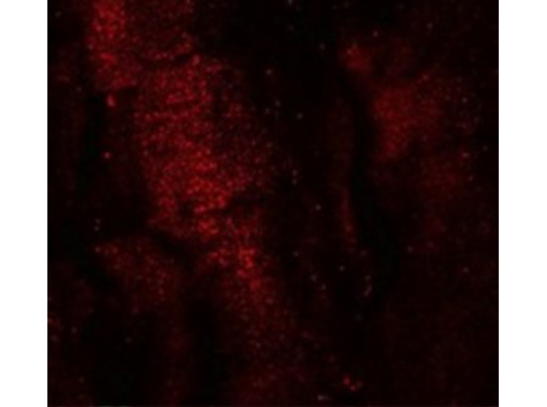 Immunofluorescence of RKHD3