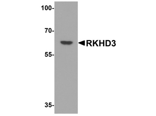 Western blot analysis of RKHD3