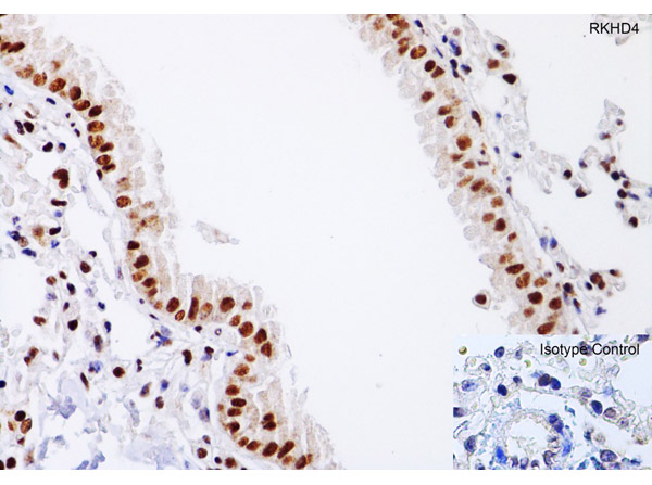Immunohistochemistry Validation of RKHD4