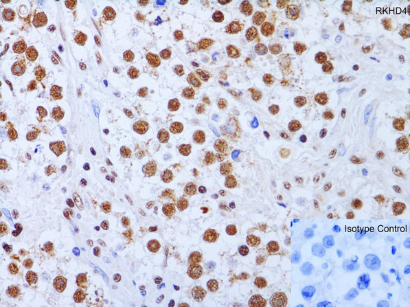 Immunohistochemistry Validation of RKHD4