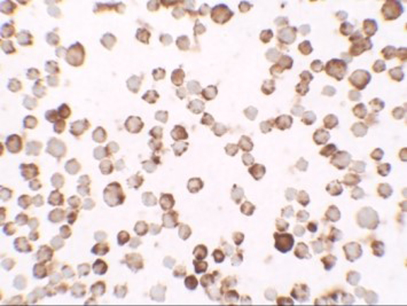 Immunocytochemistry of RNASET2