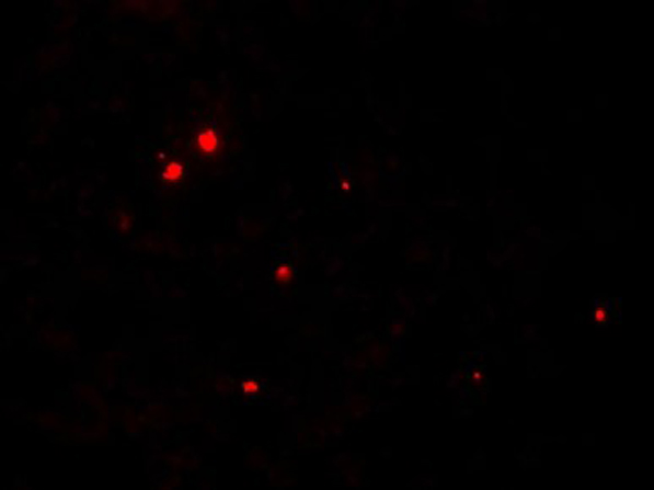 Immunofluorescence of RNASET2