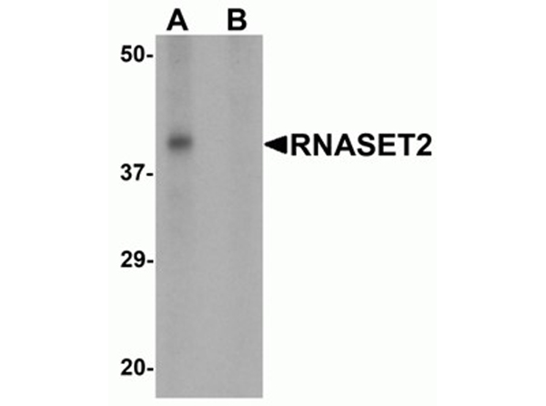 Western blot analysis of RNASET2