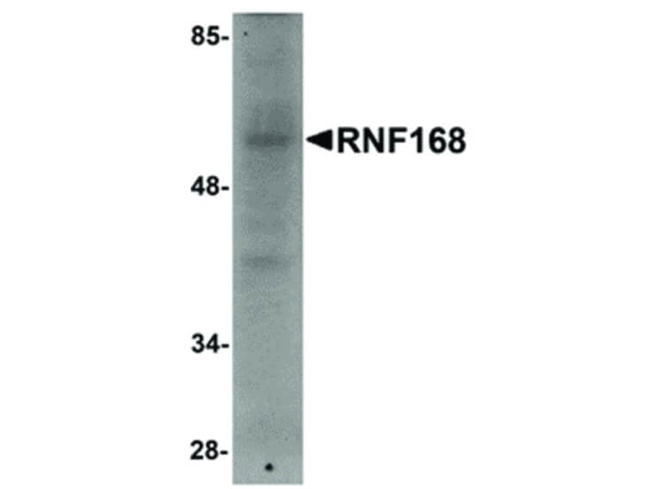Western Blot of RNF168 Antibody