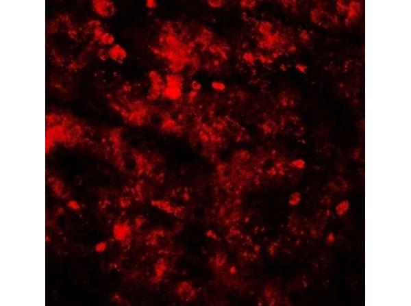 Immunofluorescence of RNF20.