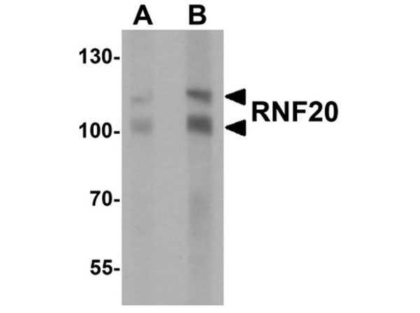Western blot of RNF20