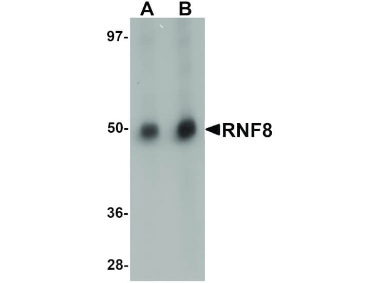 Western Blot of RNF8 Antibody