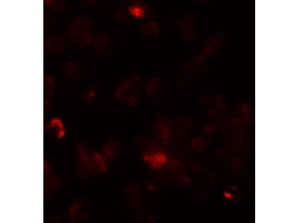 Immunofluorescence of ROCK1