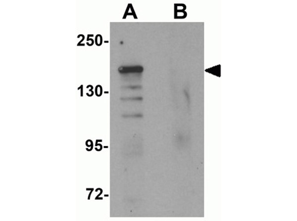 Western blot analysis of ROCK1