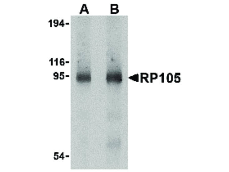 Western Blot of RP105 Antibody
