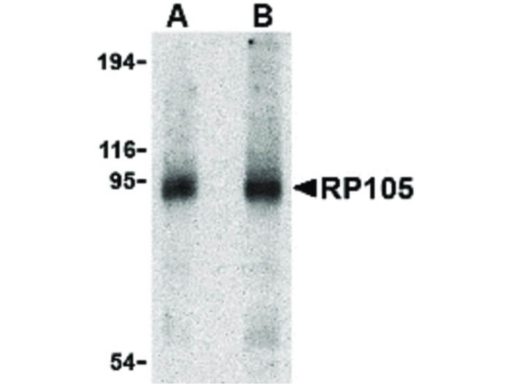 Western Blot of RP105 Antibody
