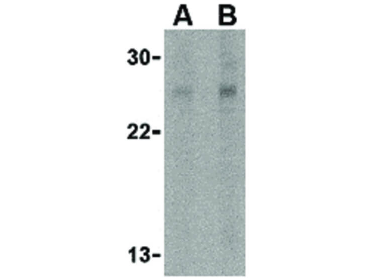 Western Blot of RPA Interacting Protein Antibody
