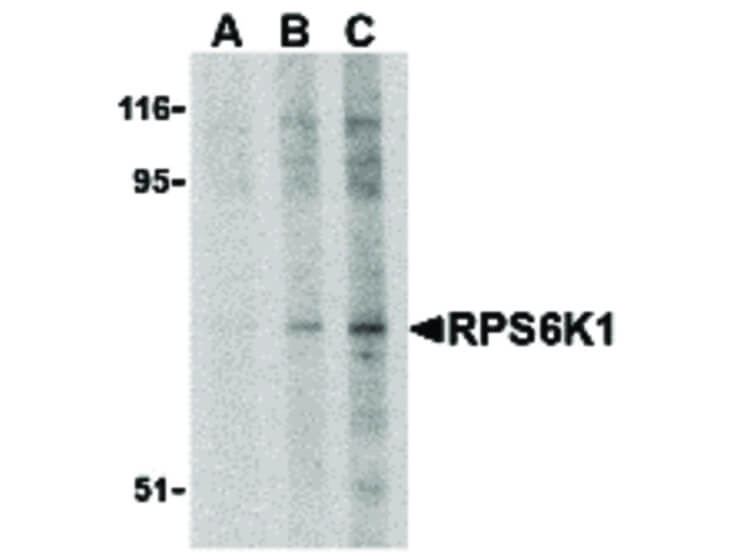 Western Blot of RPS6K1 Antibody