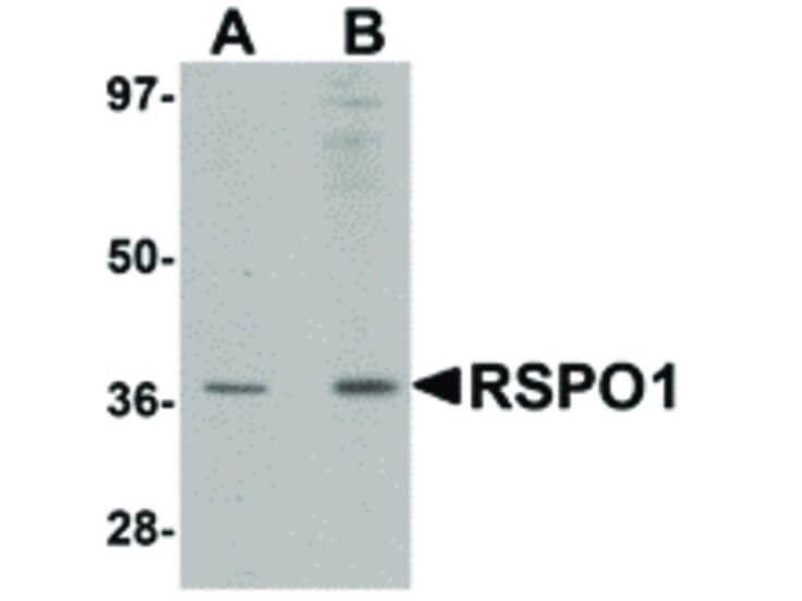 Western Blot of RSPO1 Antibody