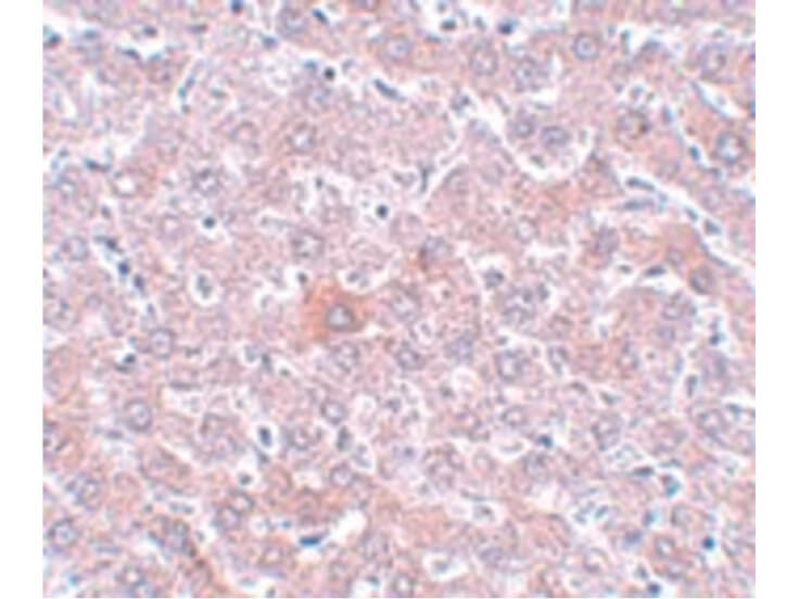 Immunohistochemistry of RSRC1 Antibody