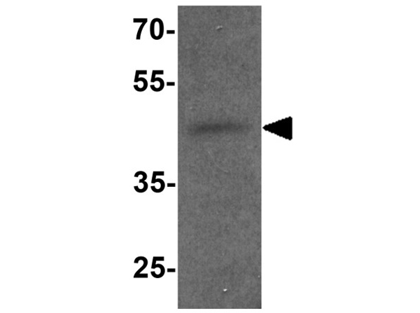 Western blot analysis of RTN4RL2