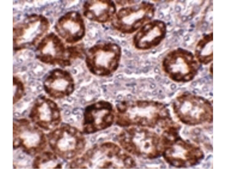 Immunohistochemistry of RTP801 Antibody