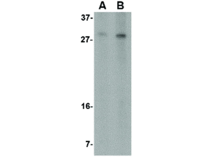 Western Blot of RTP801 Antibody