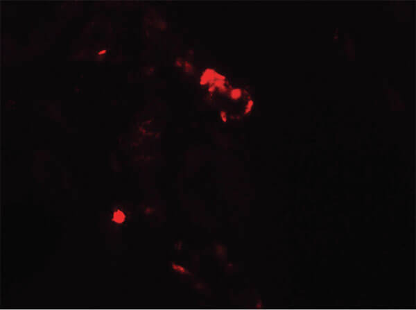 Immunofluorescence of Rubicon Antibody