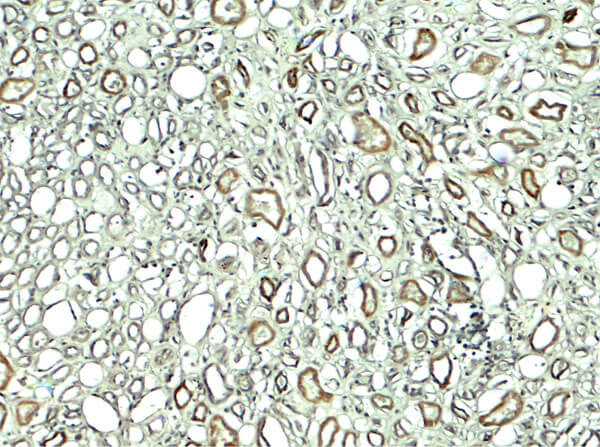 Immunohistochemistry of Rubicon Antibody