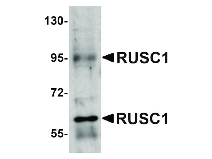 Western Blot of RUSC1 Antibody
