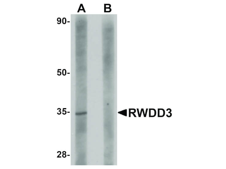 Western Blot of RWDD3 Antibody