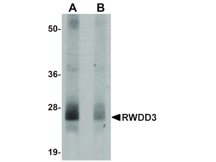 Western blot of Anti-RWDD3 Antibody.