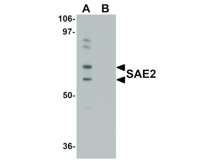 Western Blot of SAE2 Antibody