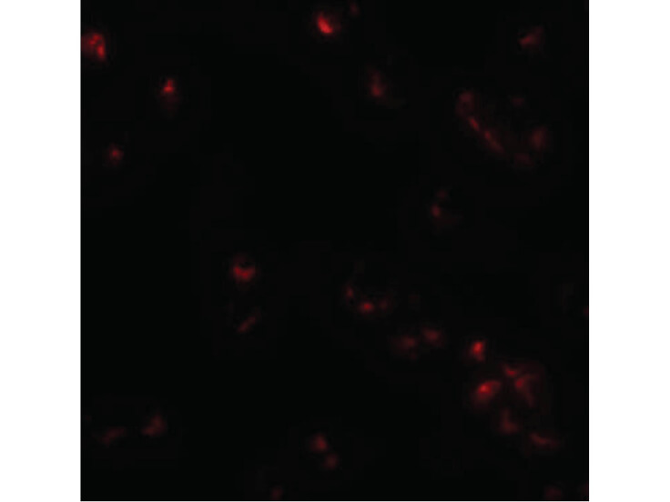 Immunofluorescence of SAE2 Antibody
