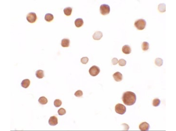 Immunocytochemistry of SAMSN