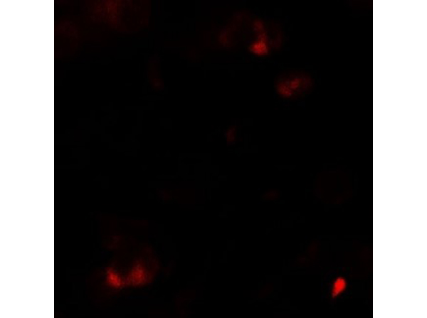 Immunofluorescence of SAMSN
