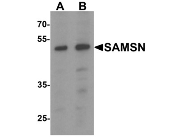 Western blot analysis of SAMSN