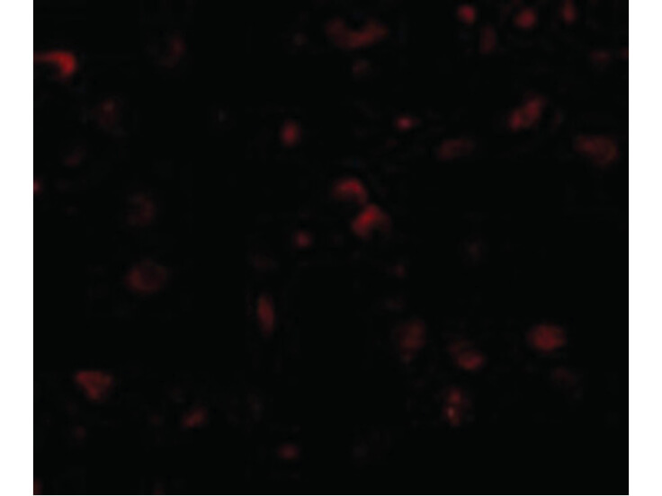 Immunofluorescence of SAPAP1 Antibody