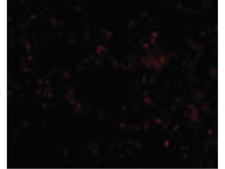 Immunofluorescence of SCARB1 Antibody
