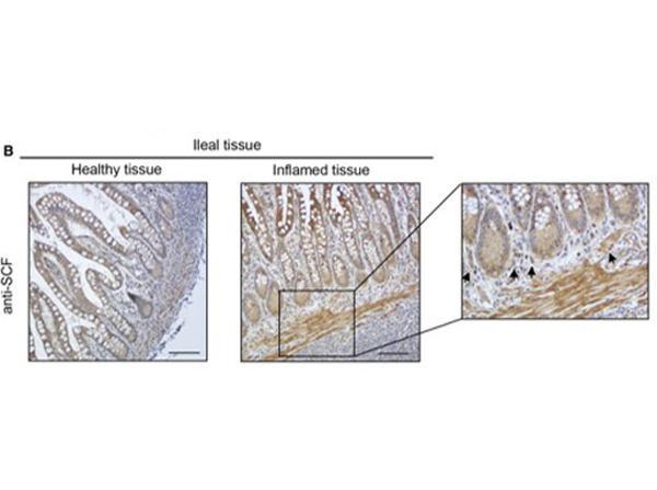 Immunohistochemistry using SCARB1