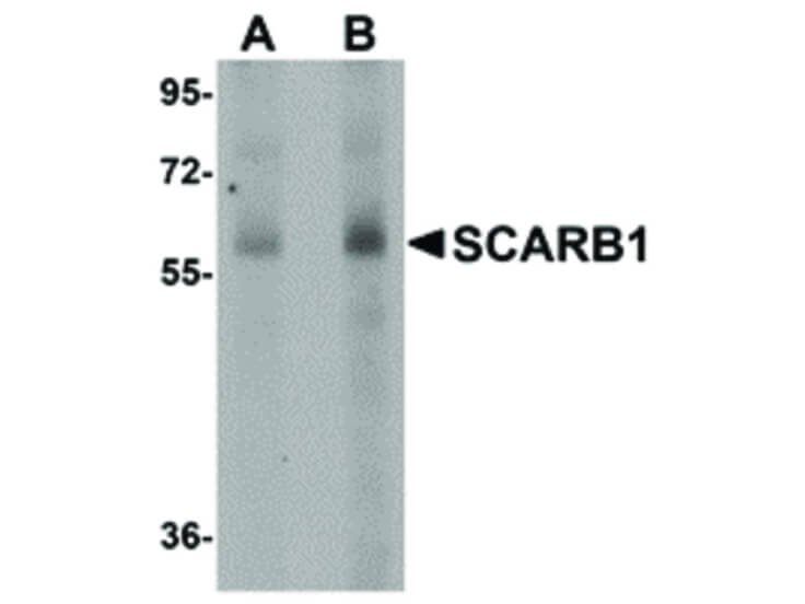 Western Blot of SCARB1 Antibody
